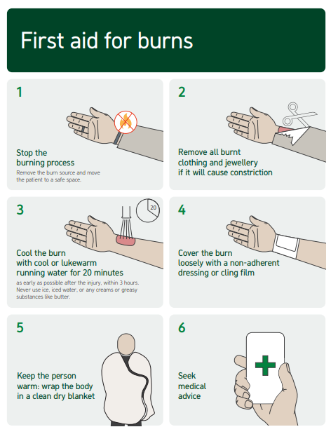 Burns first aid infographic